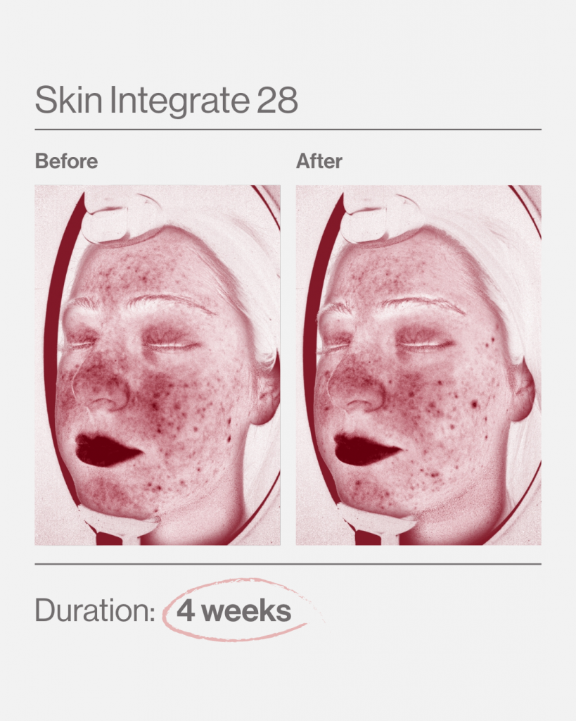 Skin Integrate Vorher-Nachher 4 Wochen Einnahme 